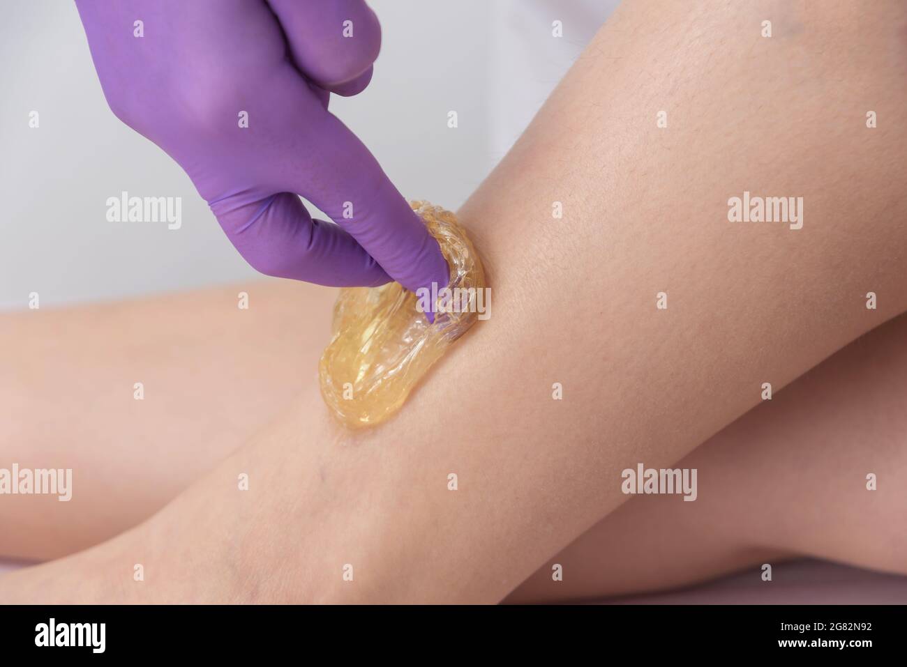 Soins de la peau épilation cuisinez avec du sucre liquide à jambes. Banque D'Images