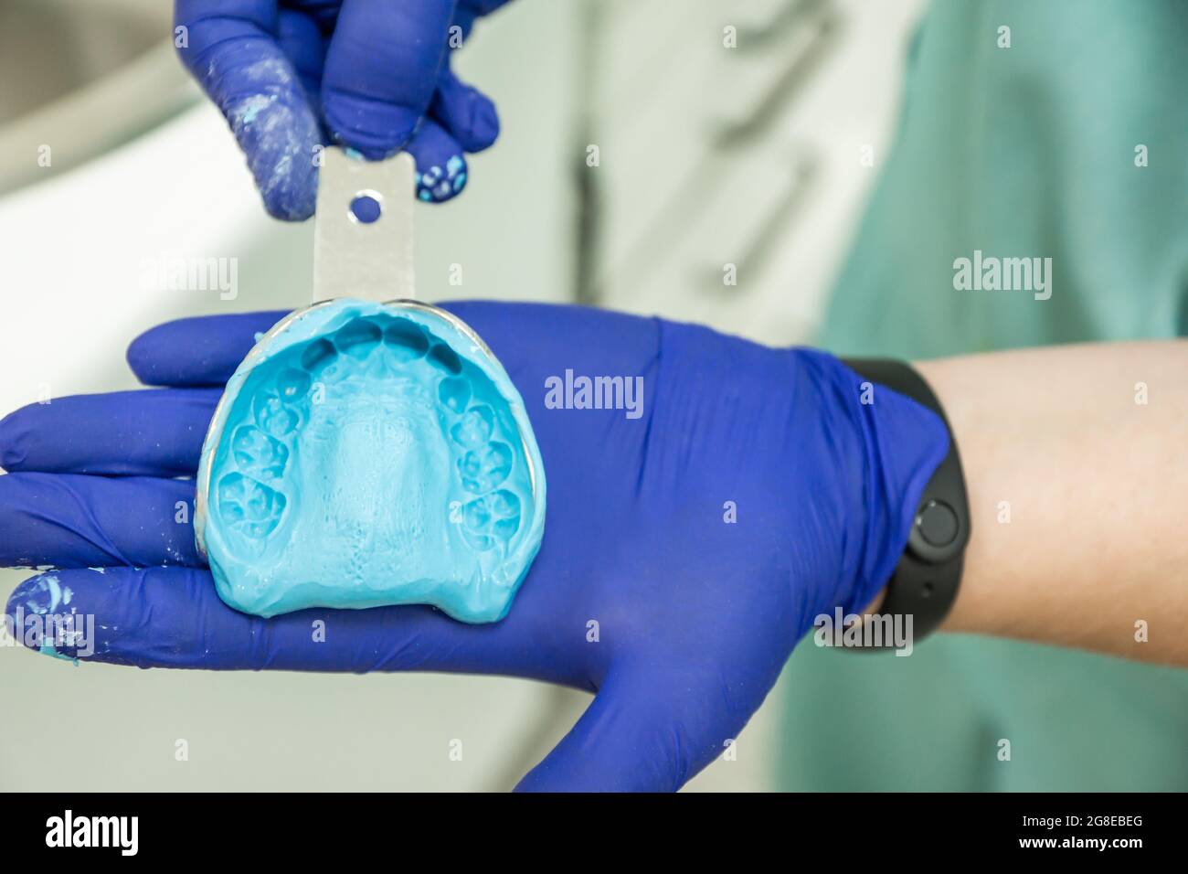mains avec des gants en latex bleu tenant le moule métallique avec alginate bleu avec impression dentaire Banque D'Images