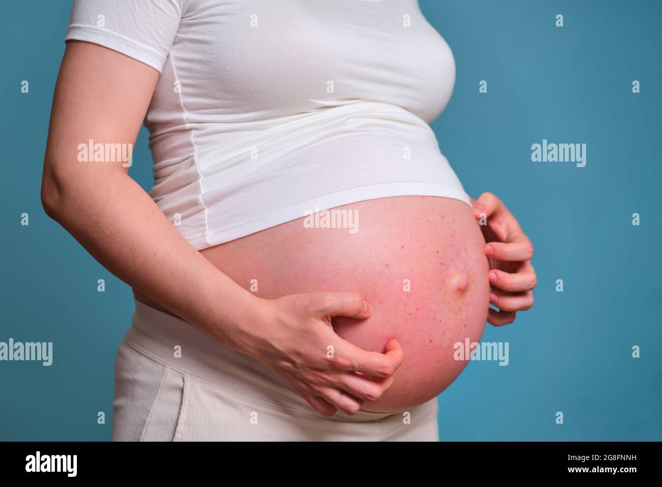 Boutons sur le ventre d'une femme enceinte, prise en studio sur ...
