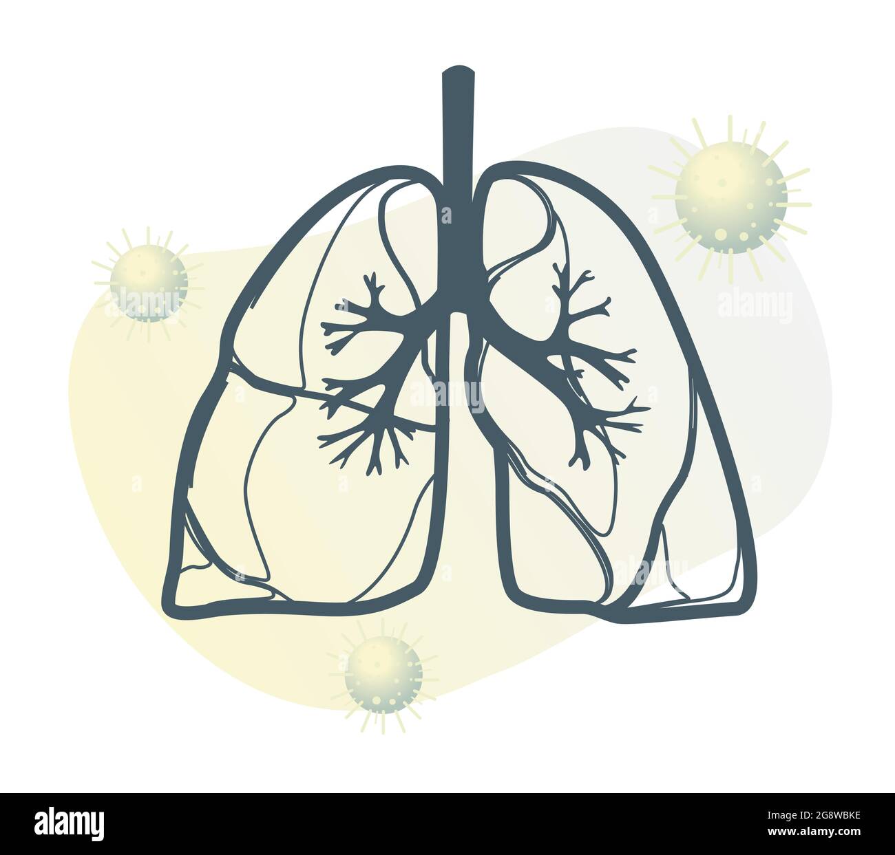 Covid-19 impact sur les poumons humains - ŒDÈME PULMONAIRE - Illustration du fichier EPS 10 Illustration de Vecteur