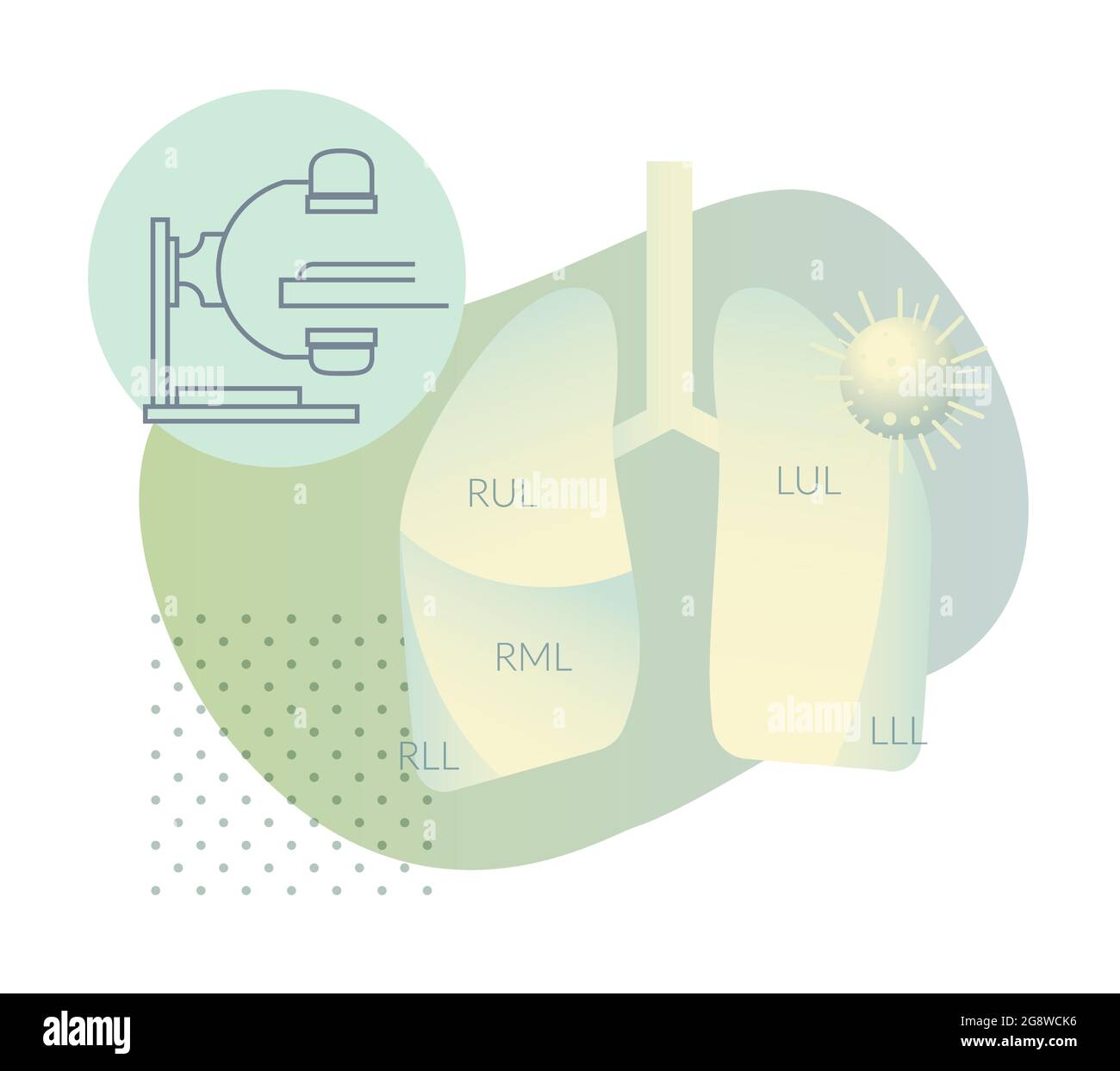 Test Covid-19 - CT Scan - HCT des poumons humains - Illustration comme fichier EPS 10 Illustration de Vecteur
