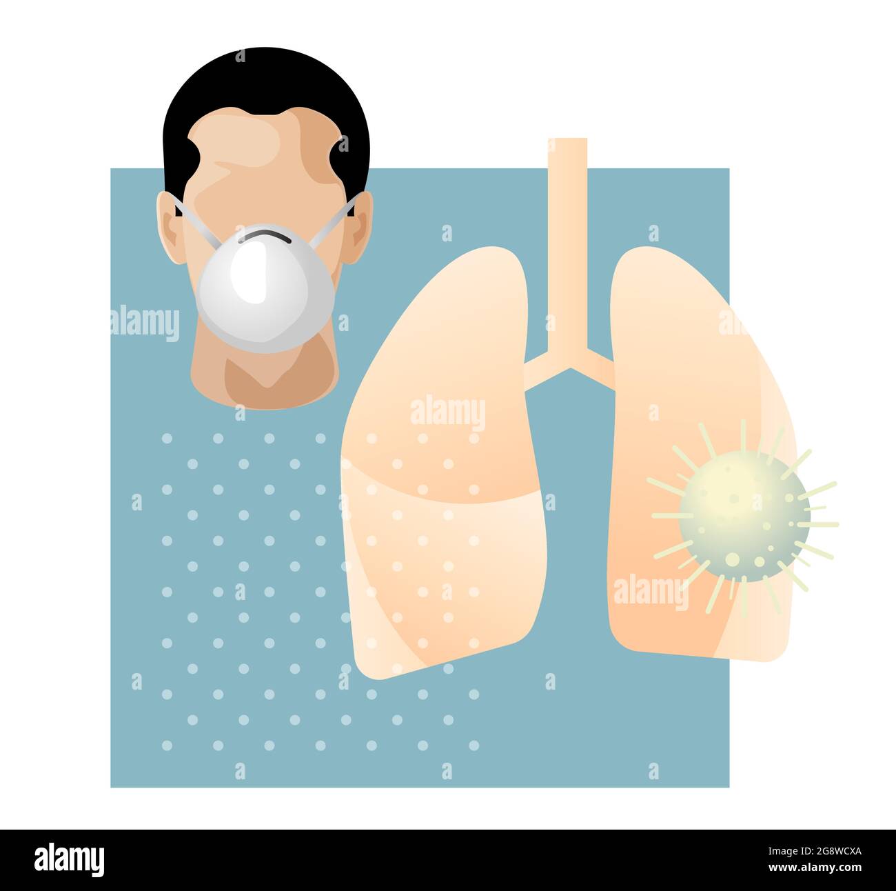 Test Covid-19 - CT Scan - HCT des poumons humains - Illustration comme fichier EPS 10 Illustration de Vecteur