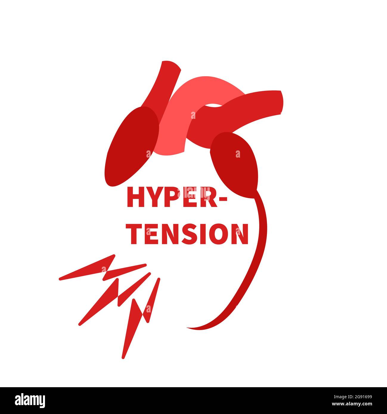 Hypertension, illustration conceptuelle Banque D'Images