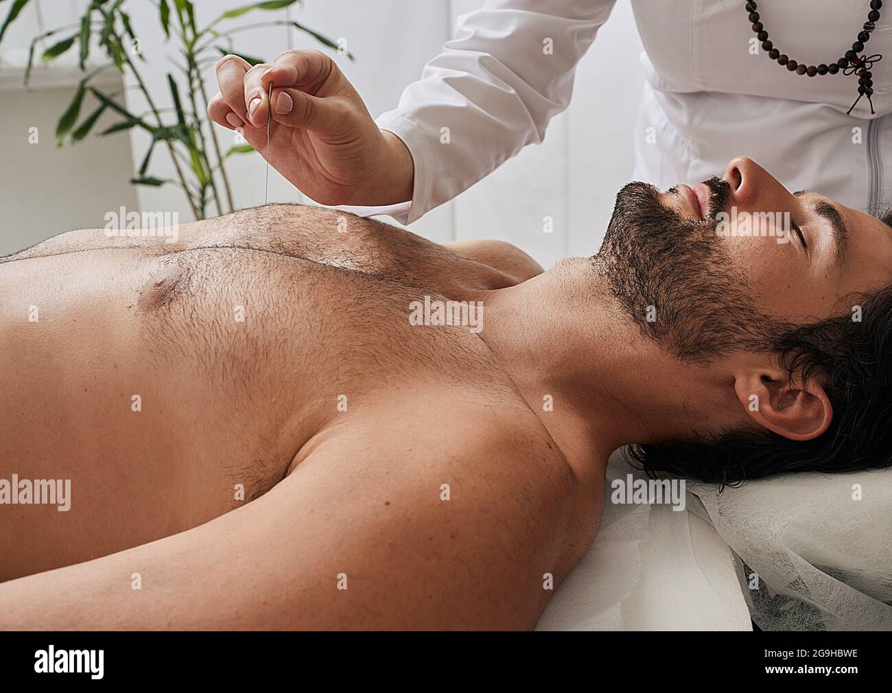 L'acupuncteur insère des aiguilles d'acupuncture à des points spéciaux sur les méridiens du corps de l'homme. Aiguilles d'acupuncture dans la main de réflexologiste, gros plan Banque D'Images