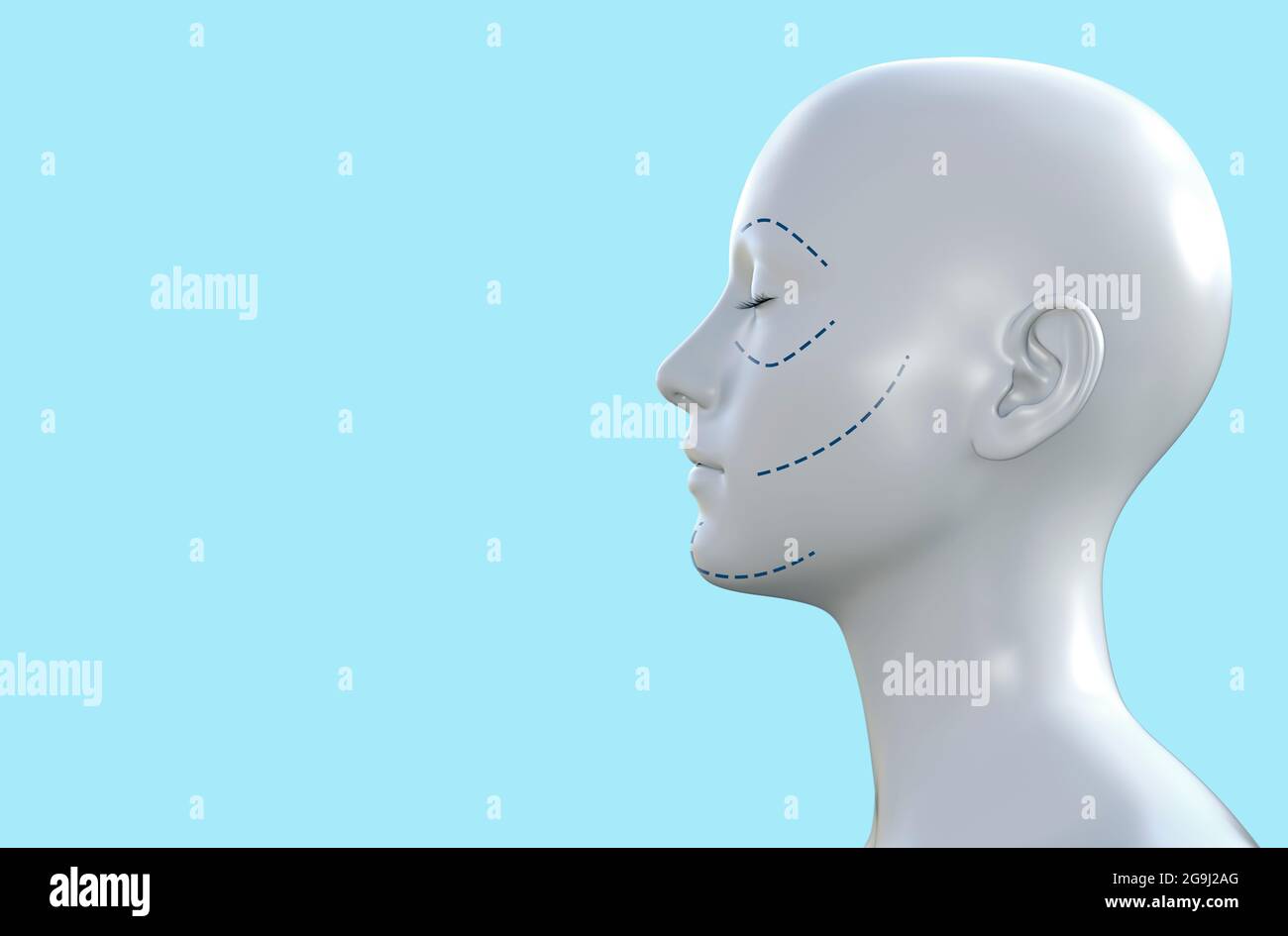 illustration du rendu 3d de la face et de la figure femelles avec des lignes de soulèvement de la face chirurgicale en plastique sur fond bleu. Banque D'Images