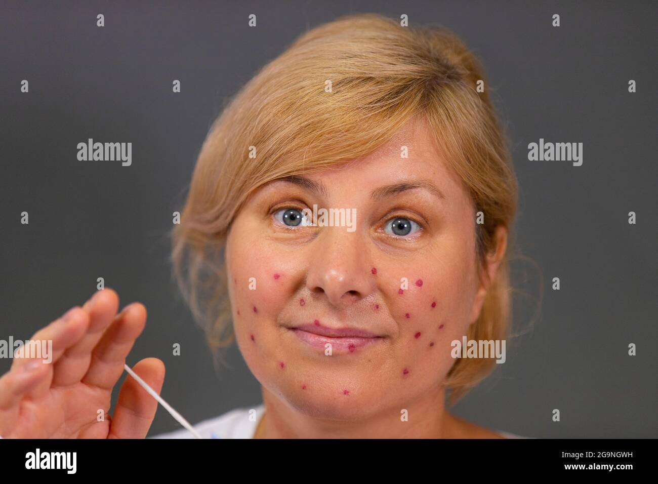Gros plan photo d'une femme blonde âgée avec un problème d'acné sur son visage, tenant le coton-tige dans sa main pour l'utiliser pour mettre un remède médical sur le Banque D'Images