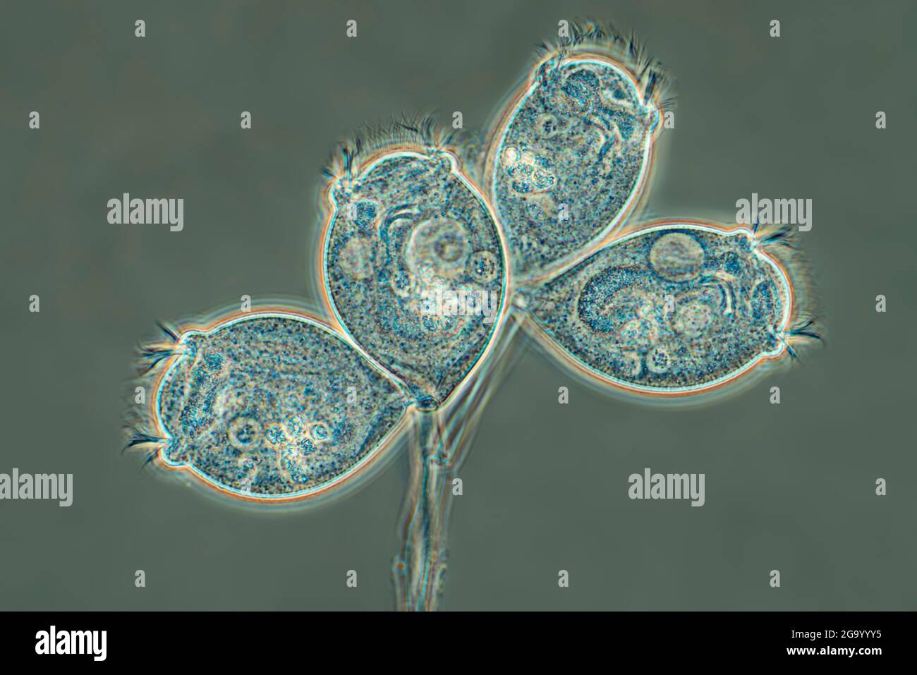 Vorticella (spécifications Vorticella), image IRM à contraste de phase, agrandissement x57 associé à une impression de 10 cm de largeur Banque D'Images