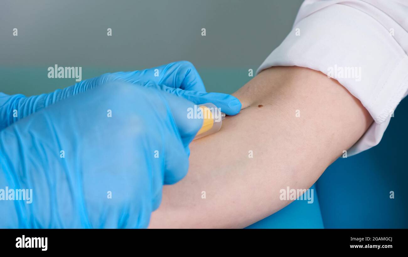 L'infirmière prélève un échantillon de sang dans la veine du patient à l'hôpital Banque D'Images