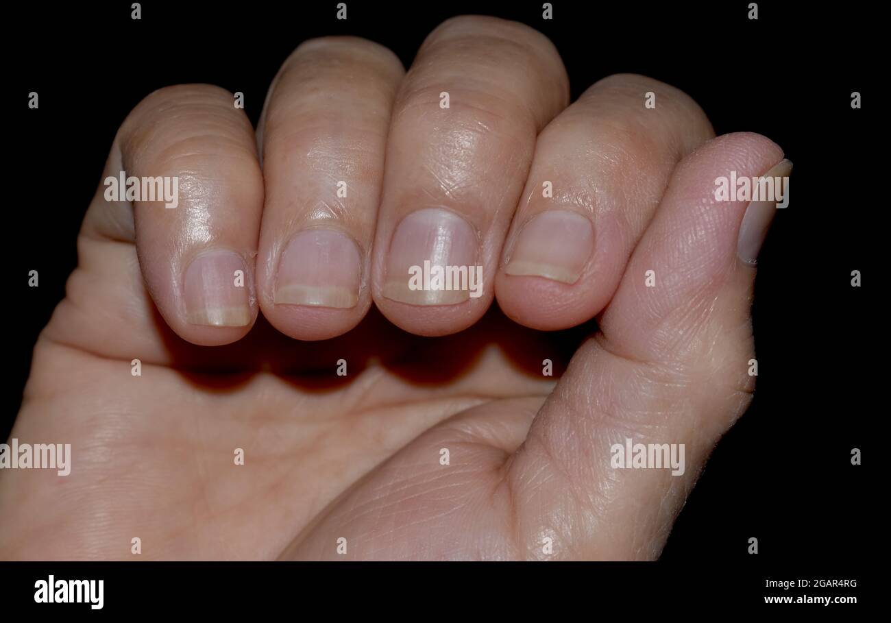 Long finger nail Banque de photographies et d'images à haute résolution -  Alamy