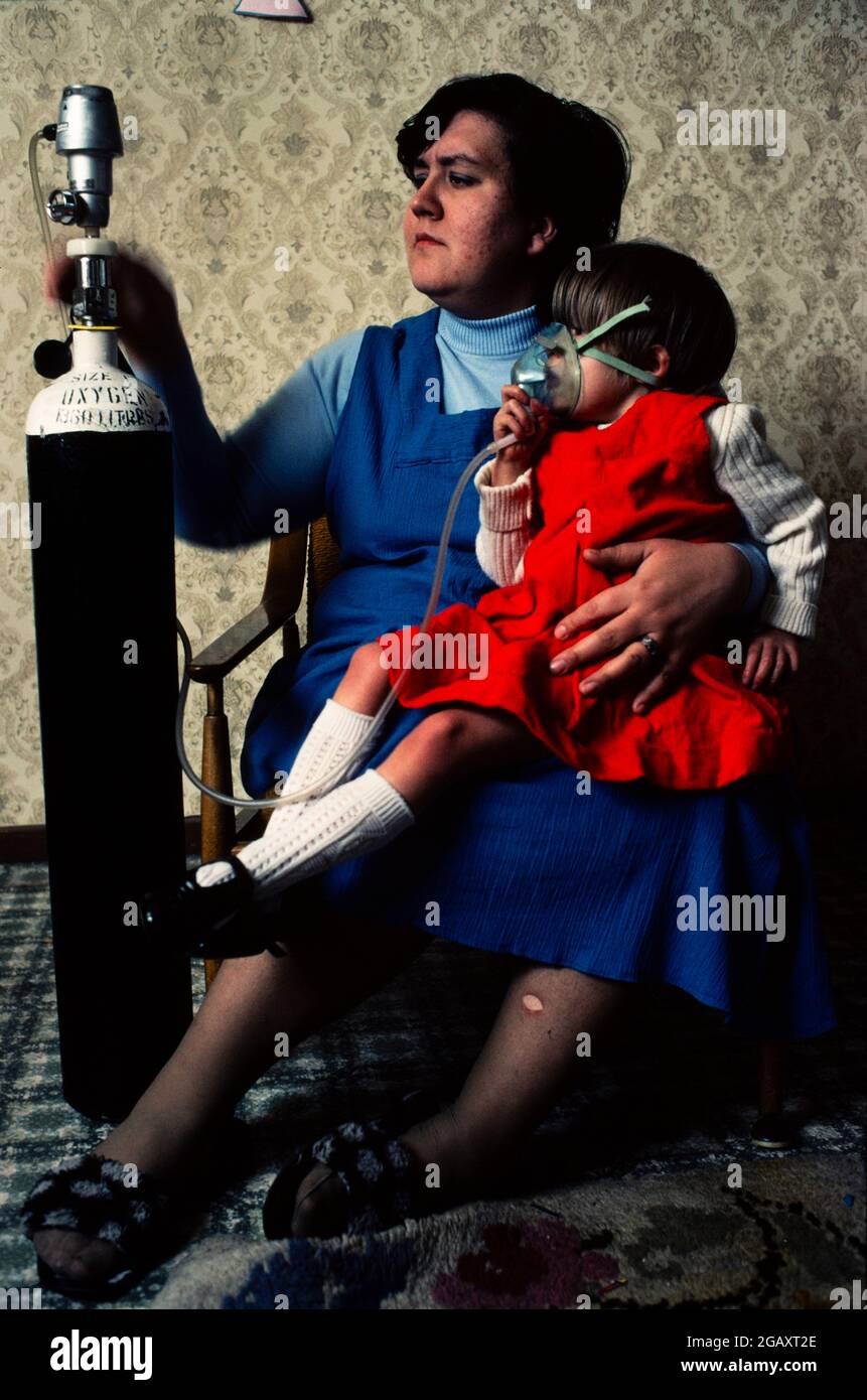 Irene Hogben donne à sa fille de quatre ans Kerry une dose d'oxygène. Les médecins reprochent à Kerry son état de santé terminal l'exposition antérieure de sa mère au produit chimique toxique 2,4,5-T alors qu'elle travaillait chez un distributeur de produits chimiques agricoles. Fév 1980. Banque D'Images