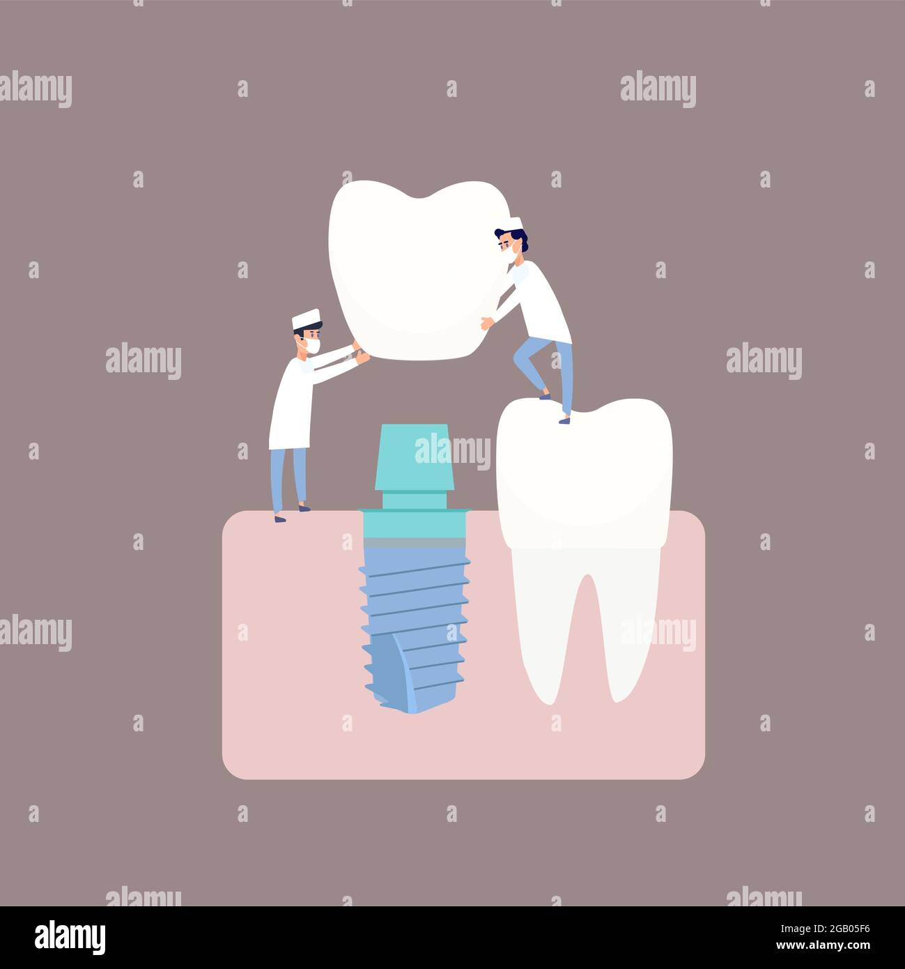 Deux dentistes effectuent l'implantation dentaire installer l'implant sur la butée. Illustration vectorielle, dans un style plat. Affiche à la clinique, image pour les instructions à l'intention des dentistes, manuels de formation. Illustration de Vecteur