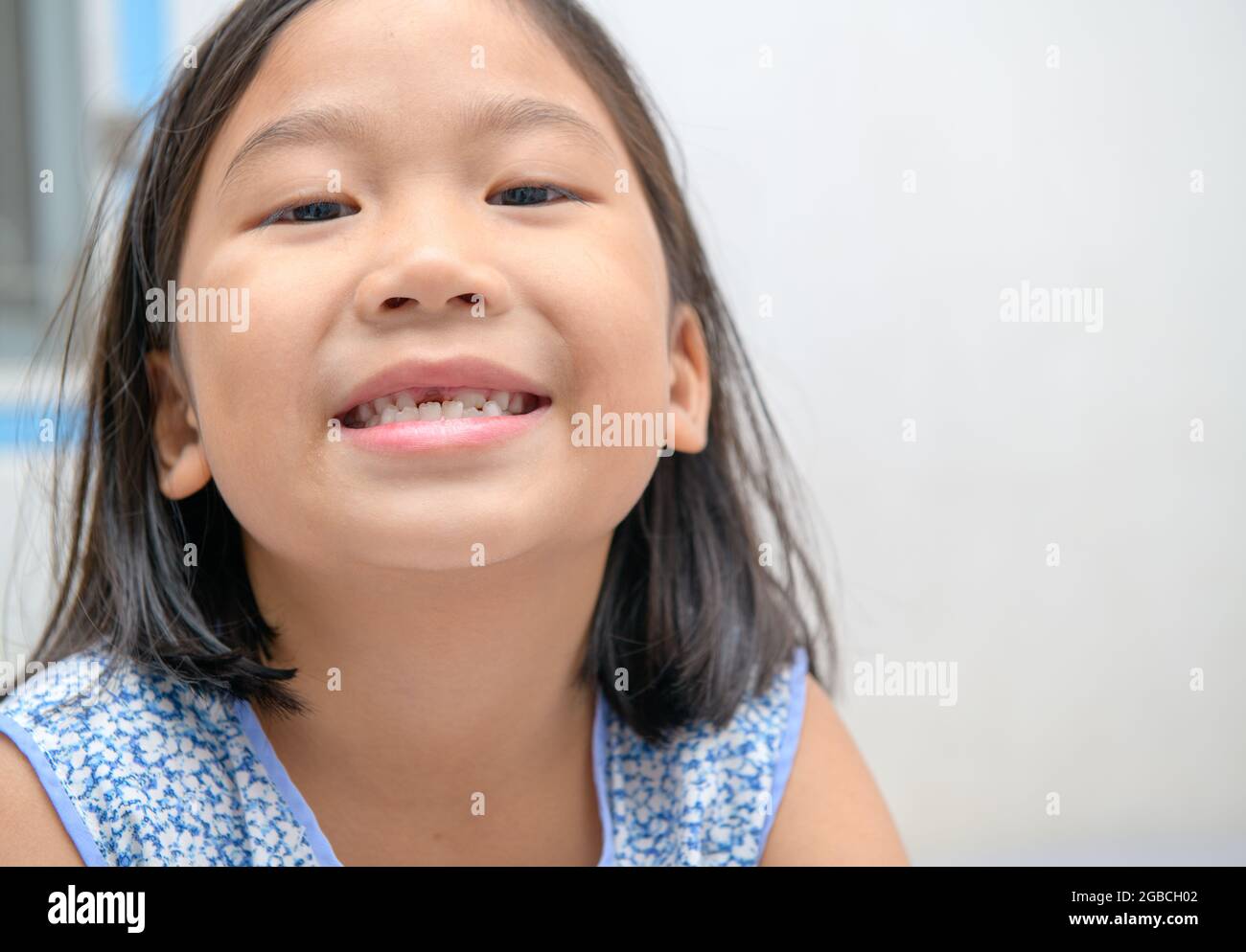 Fille asiatique sourit et montrant ses dents de lait cassées. Jolie fille a perdu ses dents de lait avant. Concept de santé orale . Banque D'Images