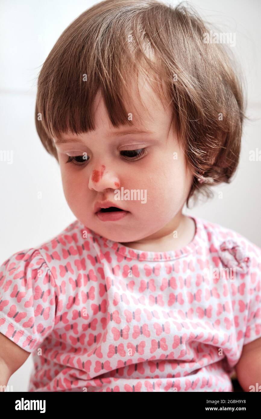 Gros plan portrait de bébé fille avec une rayure sur son nez isolé sur le  fond blanc. Concept de sécurité des enfants, blessures dues à une chute  Photo Stock - Alamy