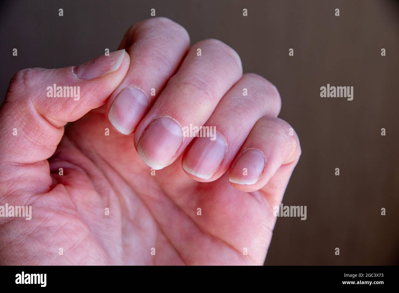 Gros plan des ongles féminins après une mauvaise manucure sur fond marron. Ongles trop gros et plaque à ongles endommagée. Concept de santé et de soins Banque D'Images