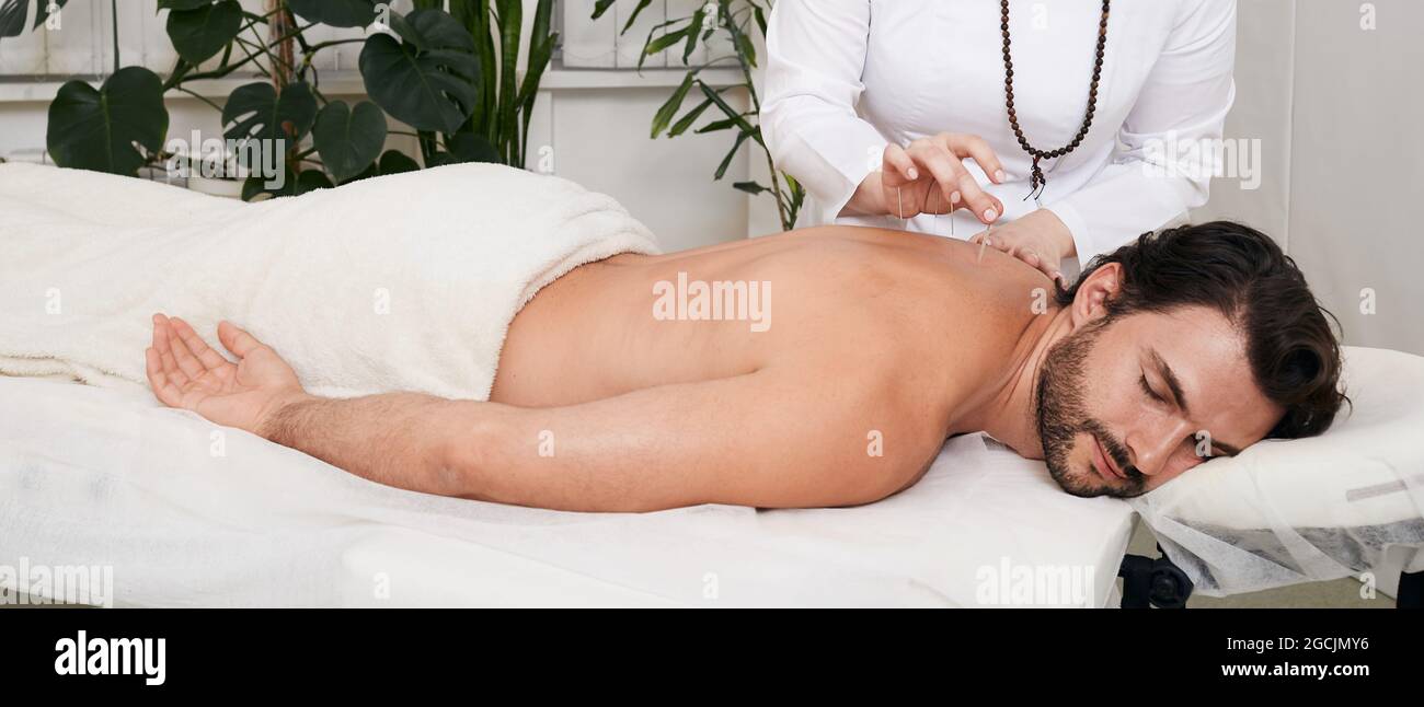 Réflexologie. Traitement des douleurs dorsales et de l'oppression avec des aiguilles d'acupuncture pour un patient mâle Banque D'Images