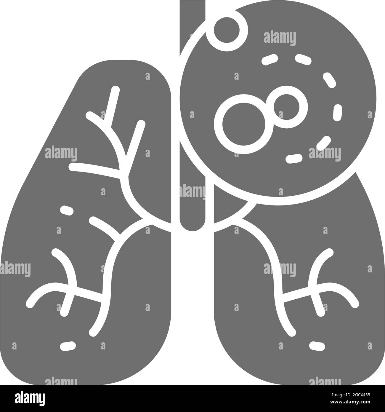 Cancer des poumons, tumeur maligne, icône grise d'oncologie. Illustration de Vecteur