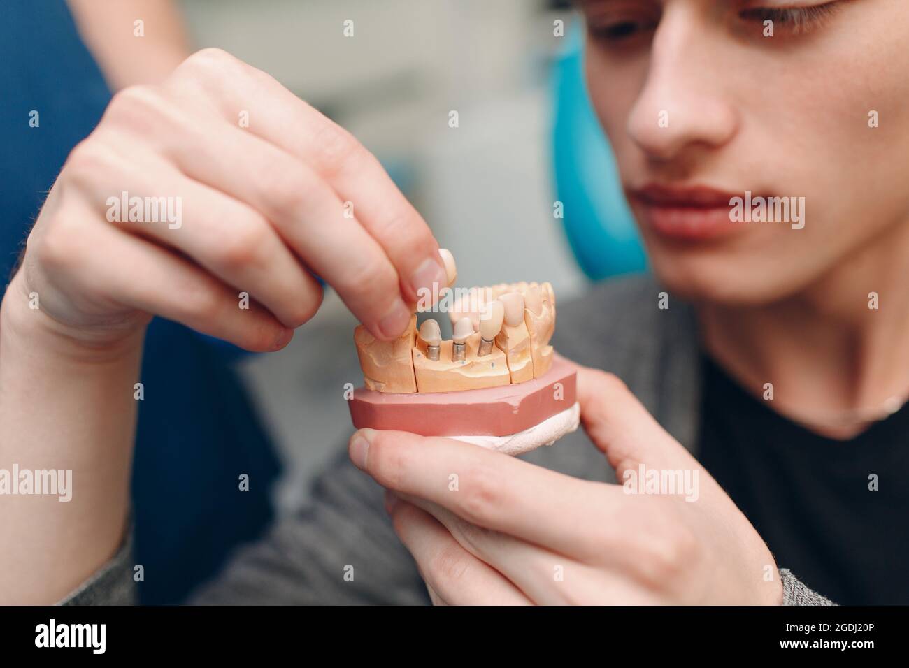 Dentisterie. Le dentiste montre des implants au patient. Clinique dentaire. Banque D'Images