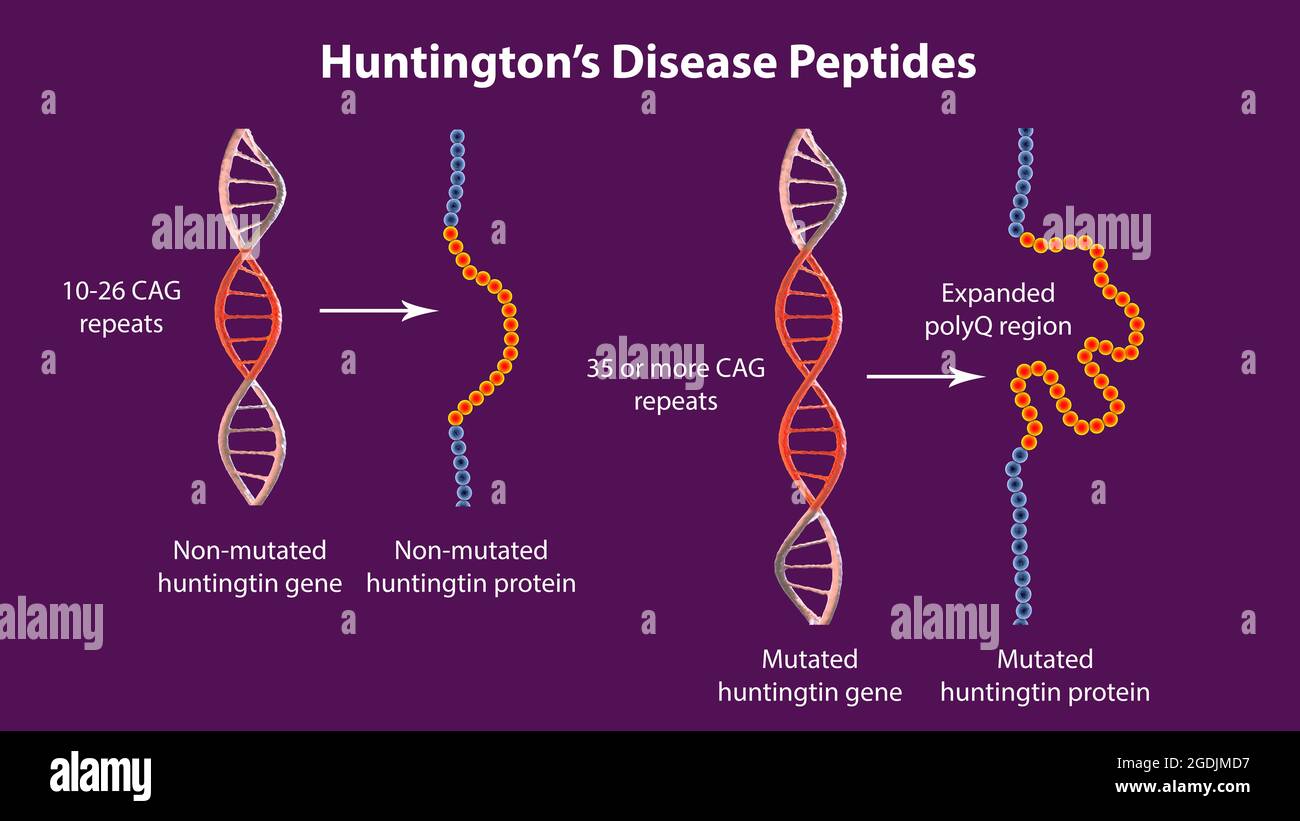 Genèse moléculaire de la maladie de Huntington, illustration 3D Banque D'Images