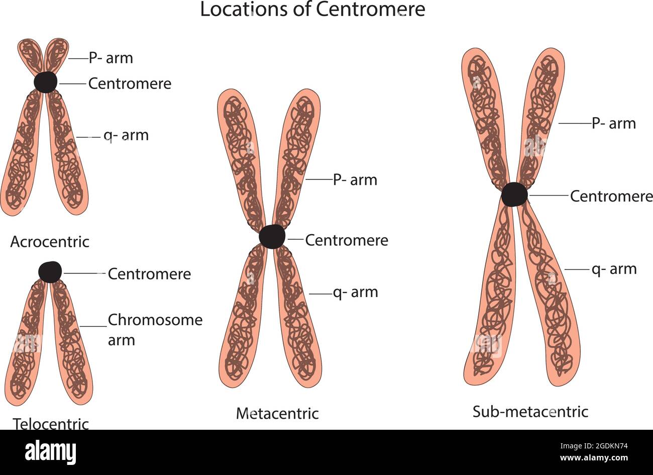 Chromosome métacentrique Banque de photographies et d’images à haute ...