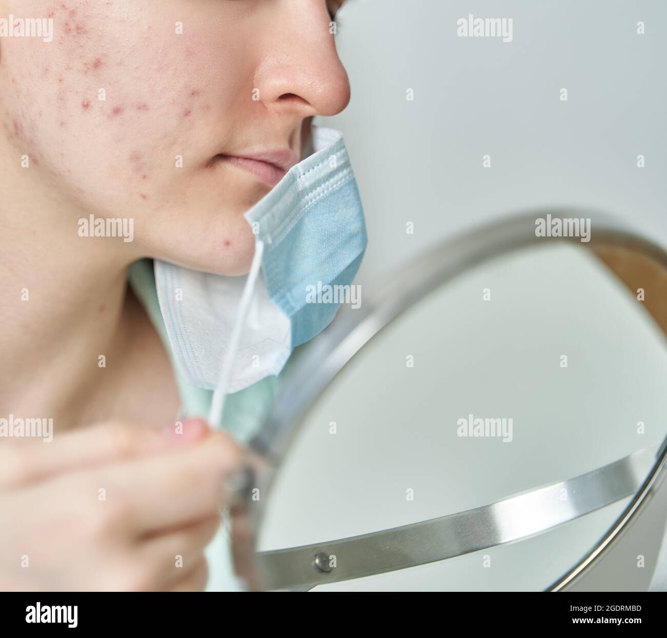 Jeune femme sans visage avec une peau problématique portant un masque médical Banque D'Images