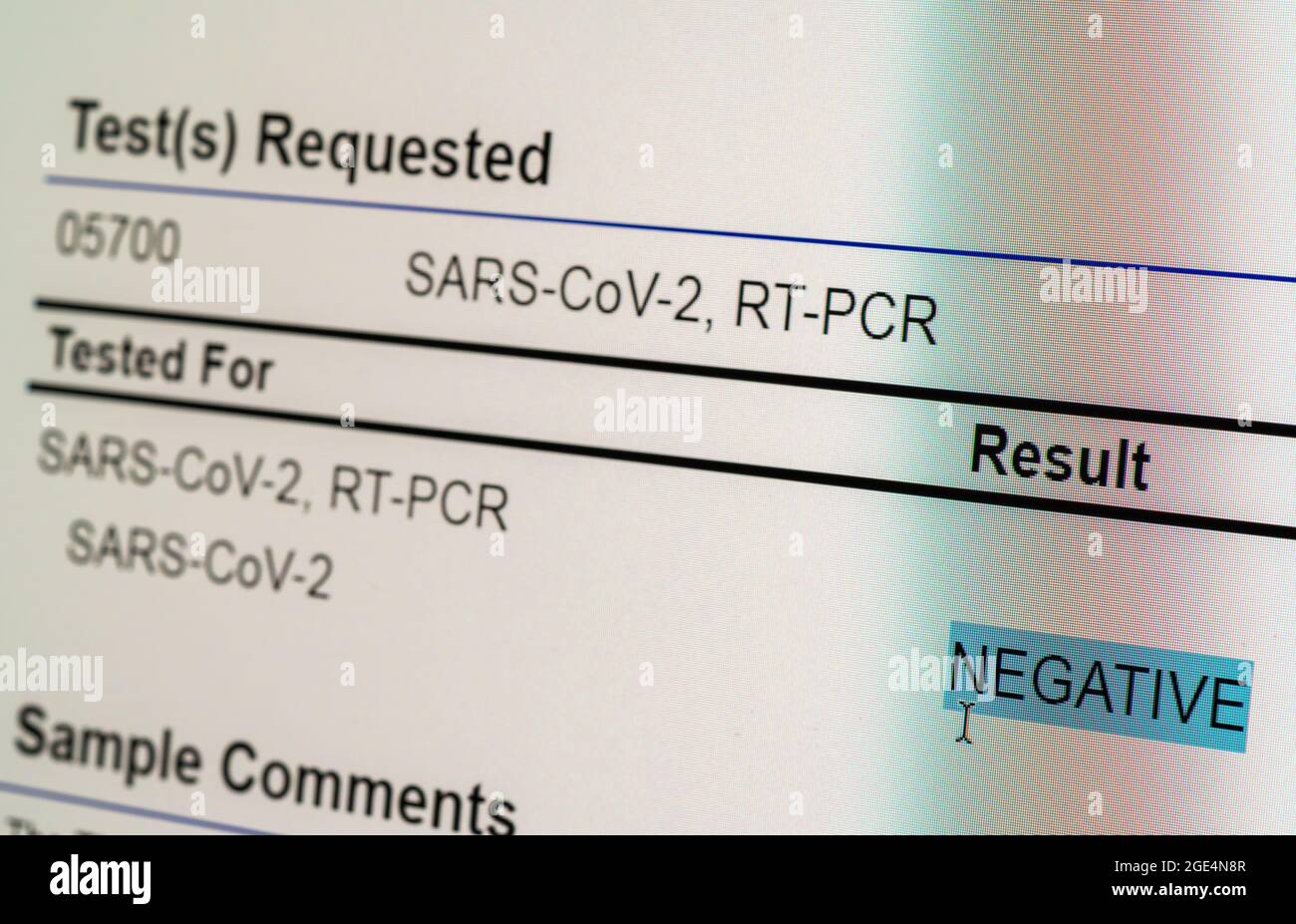 Écran d'ordinateur montrant un résultat négatif pour le test PCR sur écouvillon nasal pour le COV-SRAS-2 ou le Covid-19 Banque D'Images