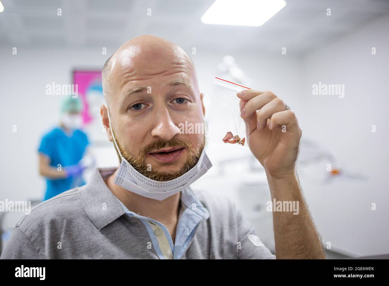 Un homme caucasien montrant ses dents dans la main après une opération d'extraction de dent de sagesse dans un hôpital dentaire. Banque D'Images