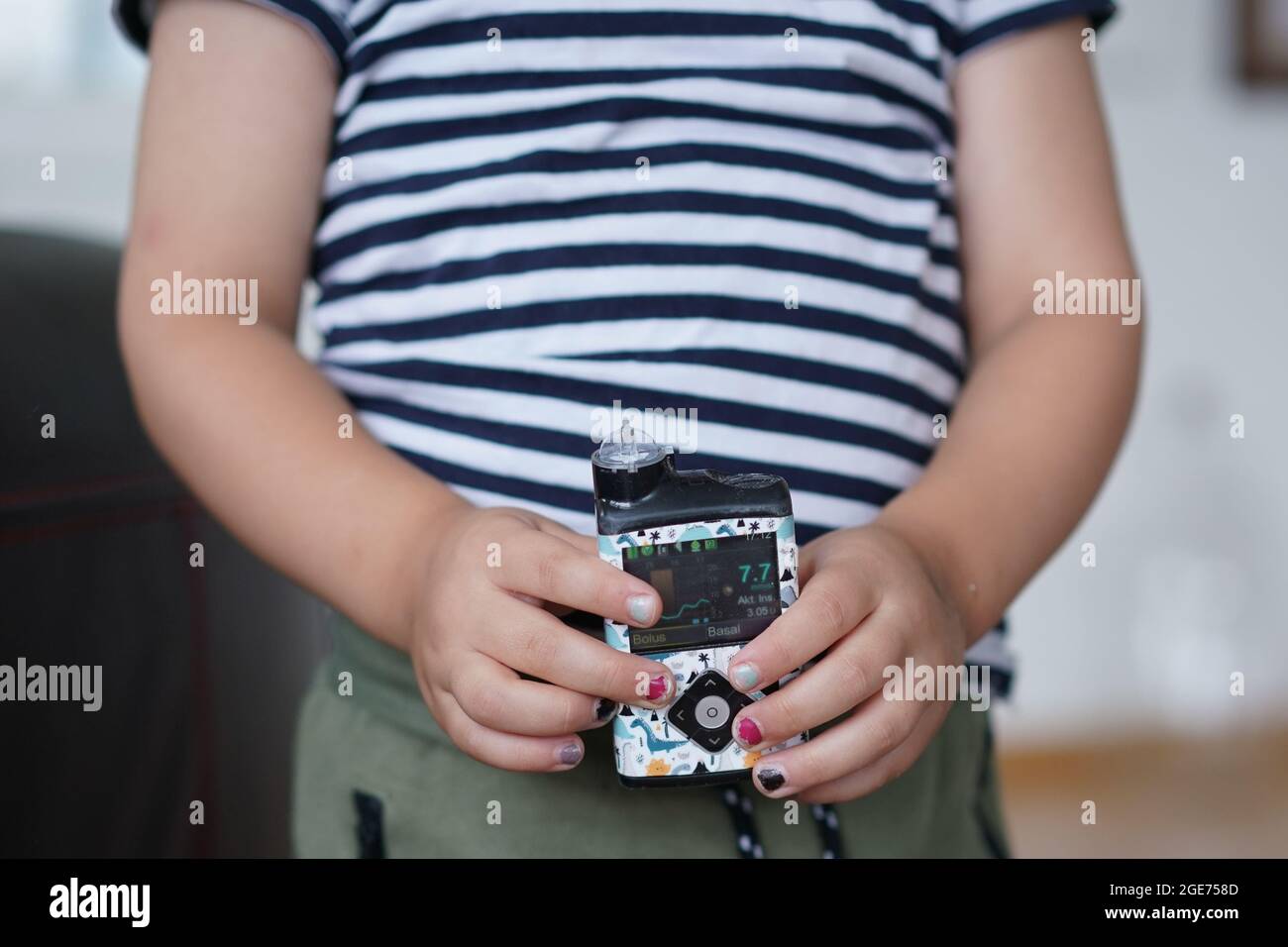Berlin, Allemagne. 03ème août 2021. Oskar, quatre ans, tient une pompe à insuline dans ses mains. En Allemagne, de plus en plus d'enfants et d'adolescents développent le diabète sucré de type 1. Beaucoup de gens ne se rendent pas compte que même des enfants et des adolescents complètement sains, sportifs et actifs peuvent développer le diabète. (À dpa 'Diabetic: Il peut affecter même les plus jeunes') Credit: Jörg Carstensen/dpa/Alay Live News Banque D'Images