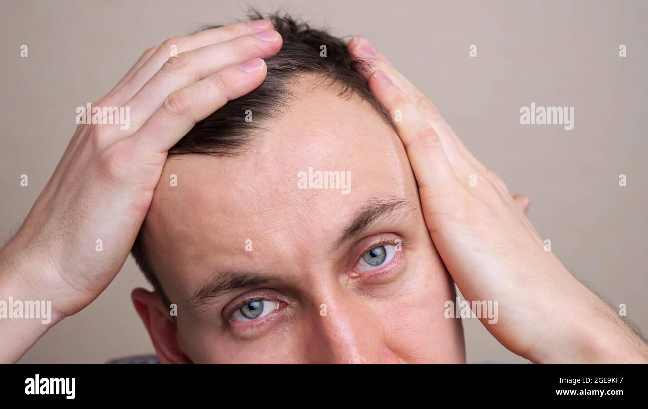 l'homme examine un point chauve sur sa tête dans un miroir au ralenti Banque D'Images