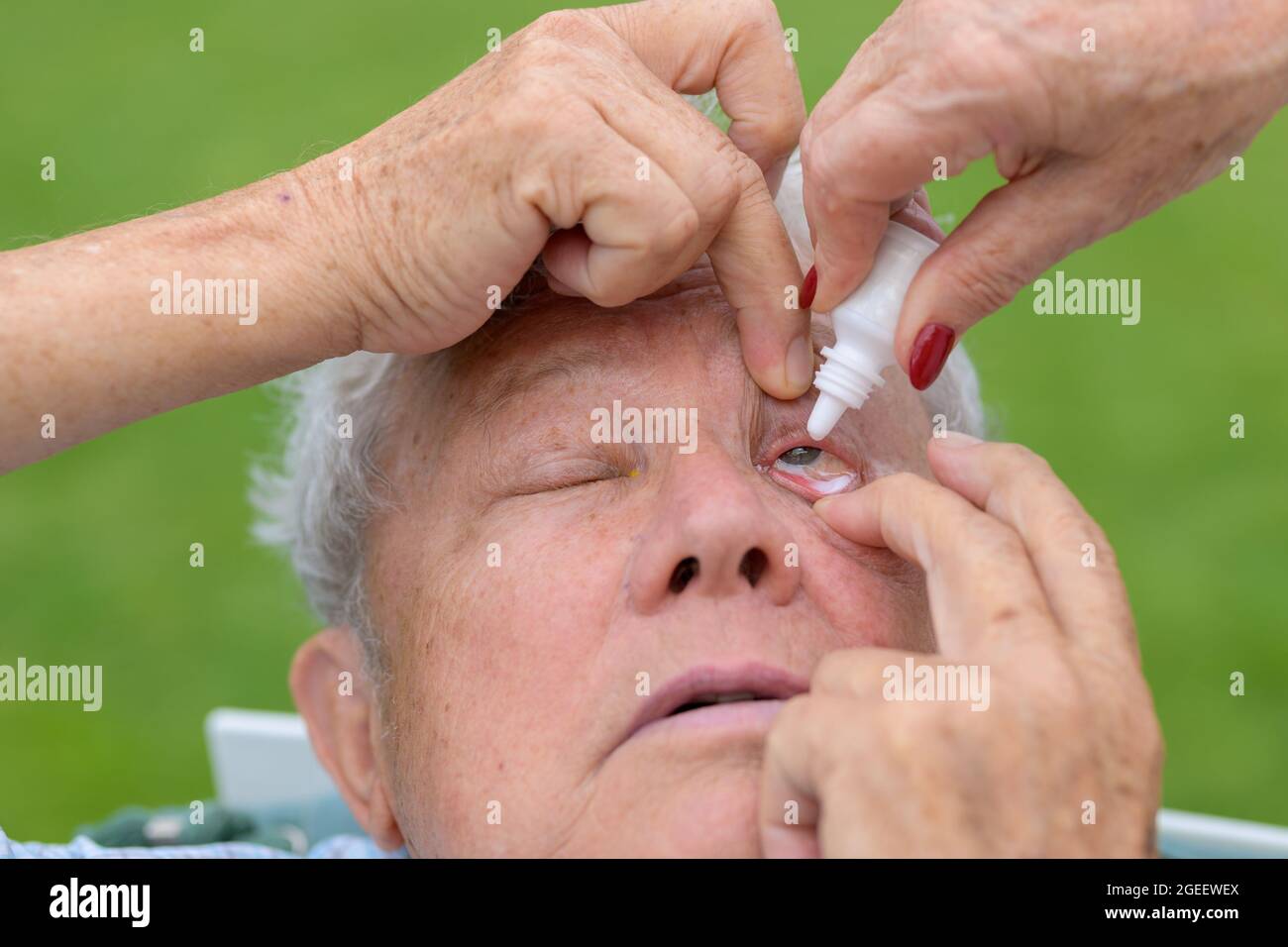 Femme administrant des eyedrops à un homme âgé en traitant ses yeux pour une maladie en gros plan sur sa tête, les gouttes dans une bouteille et sa main Banque D'Images