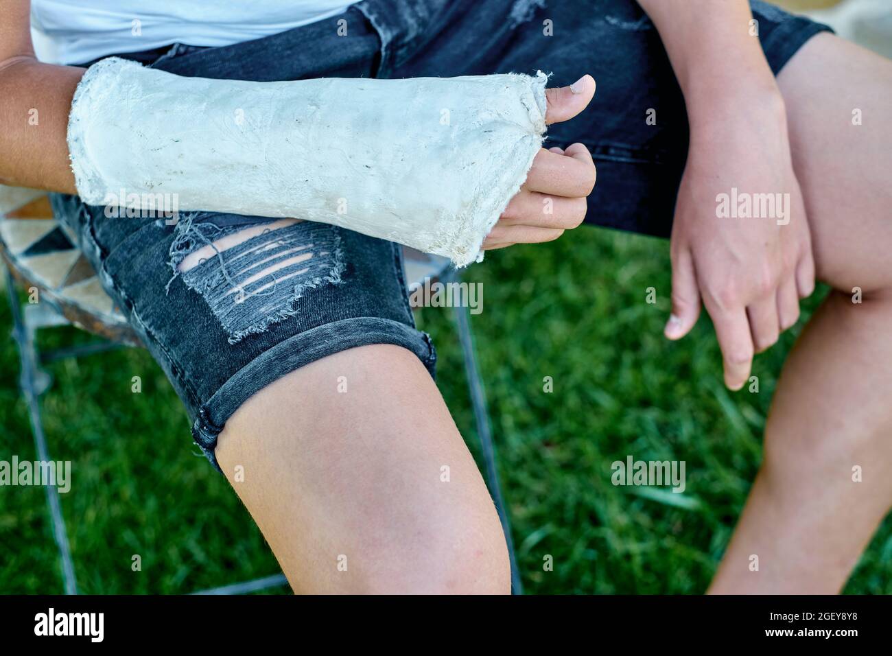 Gros plan d'un jeune garçon avec un bras cassé et moulé assis dans une chaise à l'extérieur dans un jardin. Concept de style de vie. Banque D'Images