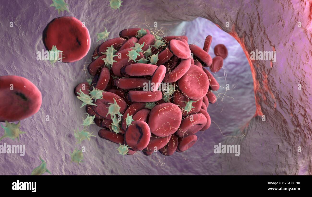 Caillot de sang, illustration. Banque D'Images