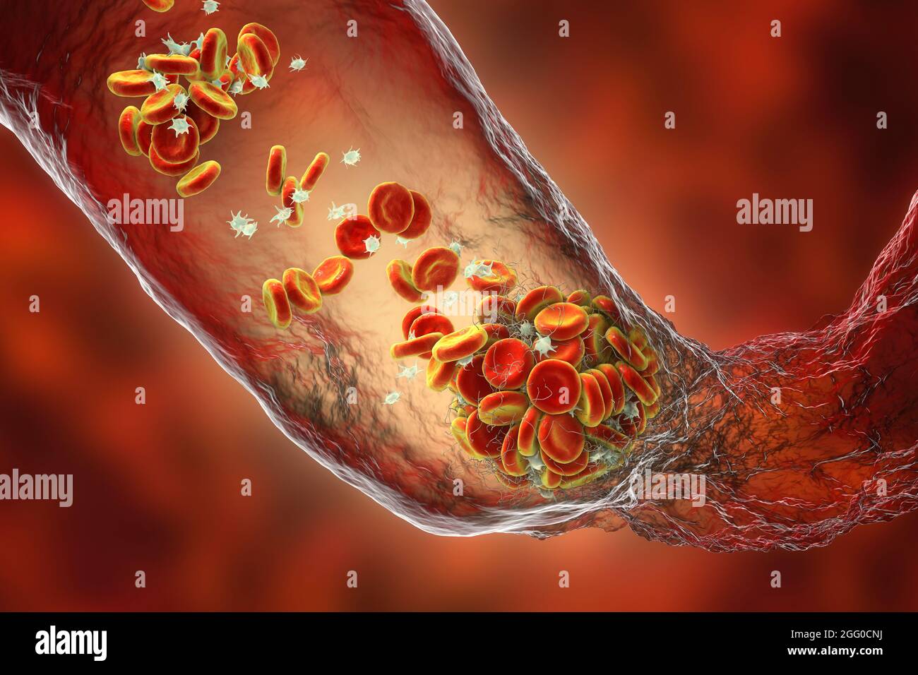 Caillot Banque D'image Et Photos - Alamy