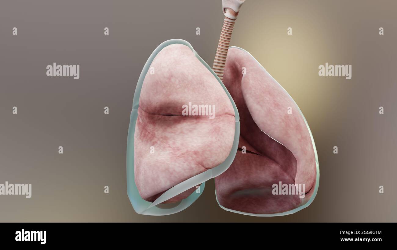illustration 3d du pneumothorax, poumon normal versus collapsus, symptômes du pneumothorax, épanchement pleural, empyema, complications après une blessure à la poitrine Banque D'Images