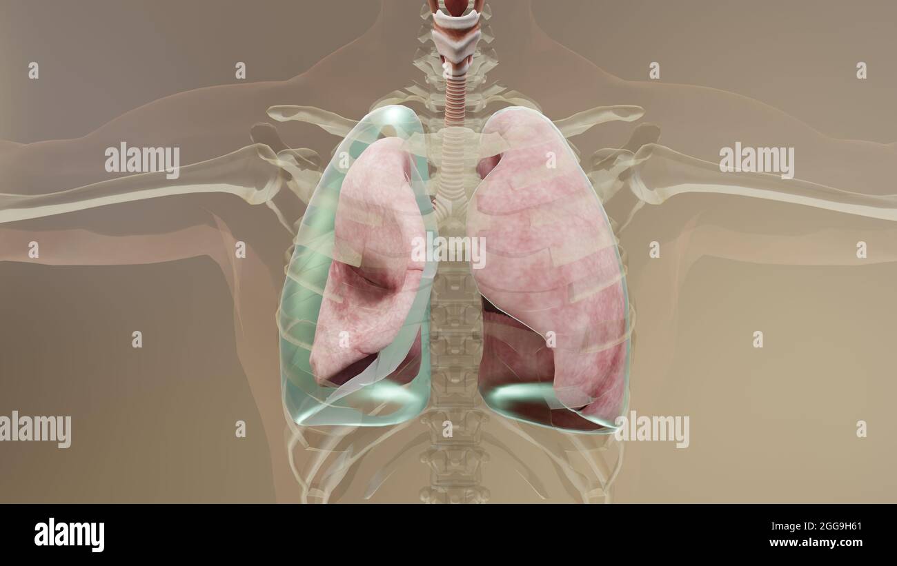 illustration 3d du pneumothorax, poumon normal versus collapsus, symptômes du pneumothorax, épanchement pleural, empyema, complications après une blessure à la poitrine Banque D'Images