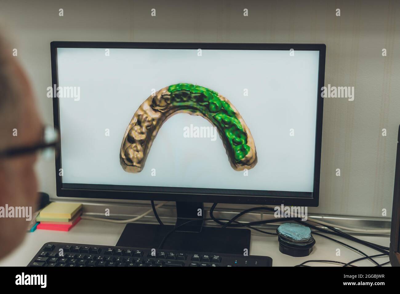 Professionnel regardant un écran d'ordinateur avec une image numérisée d'un moule dentaire dans un laboratoire Banque D'Images