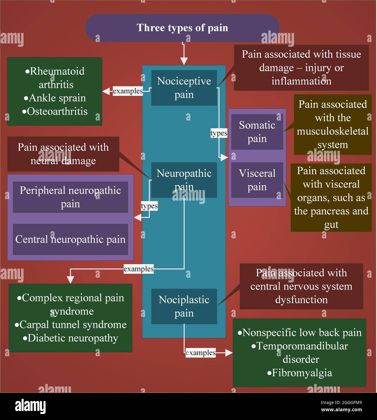 La douleur a trois types de base Banque D'Images