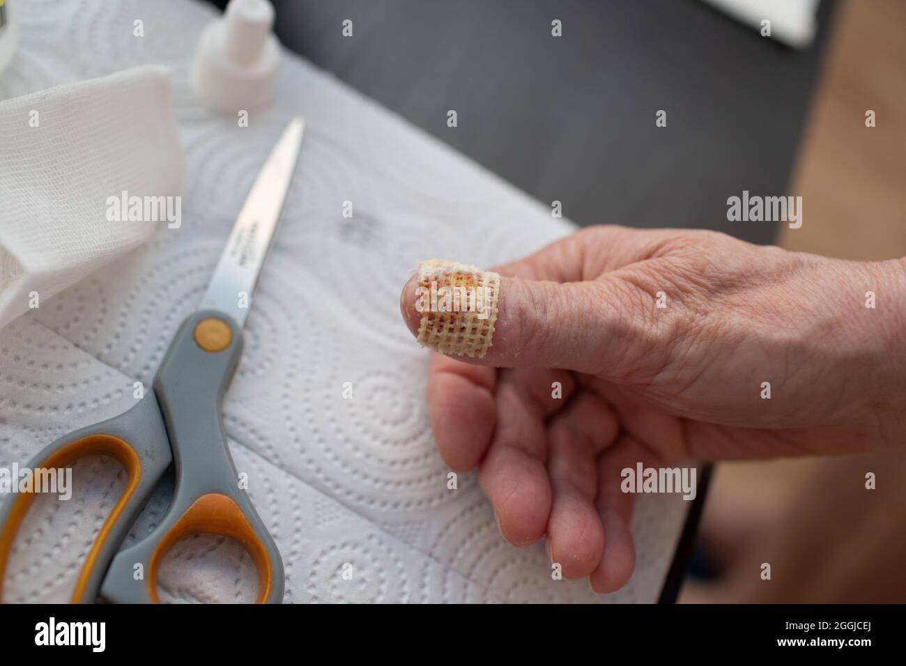 Feutre blanc sur la main doigt pointe blessé pour perdre le traitement des ongles et ongles retirés Banque D'Images