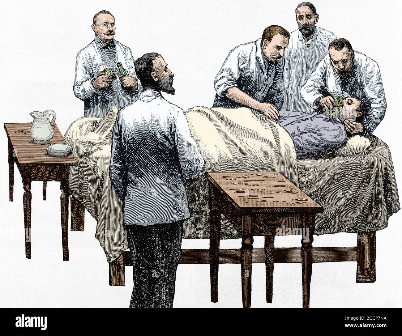 Anesthésie au chloroforme. Banque D'Images