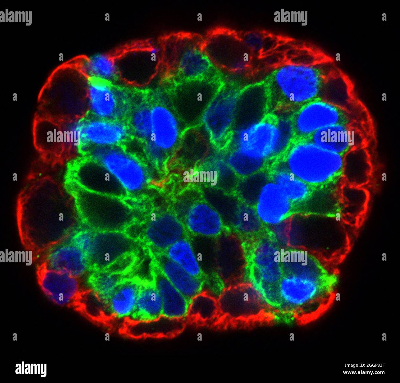 Cette image montre un organoïde cultivé à partir d'une seule cellule de tige mammaire. Banque D'Images
