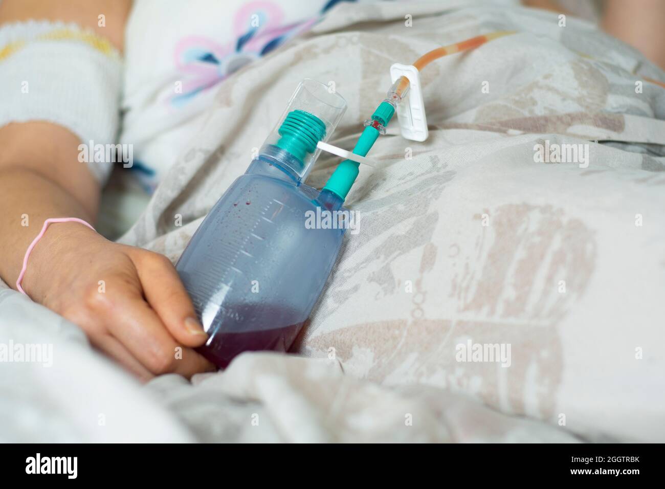 La femme tient un drainage chirurgical pendant qu'elle est au lit après l'opération Banque D'Images