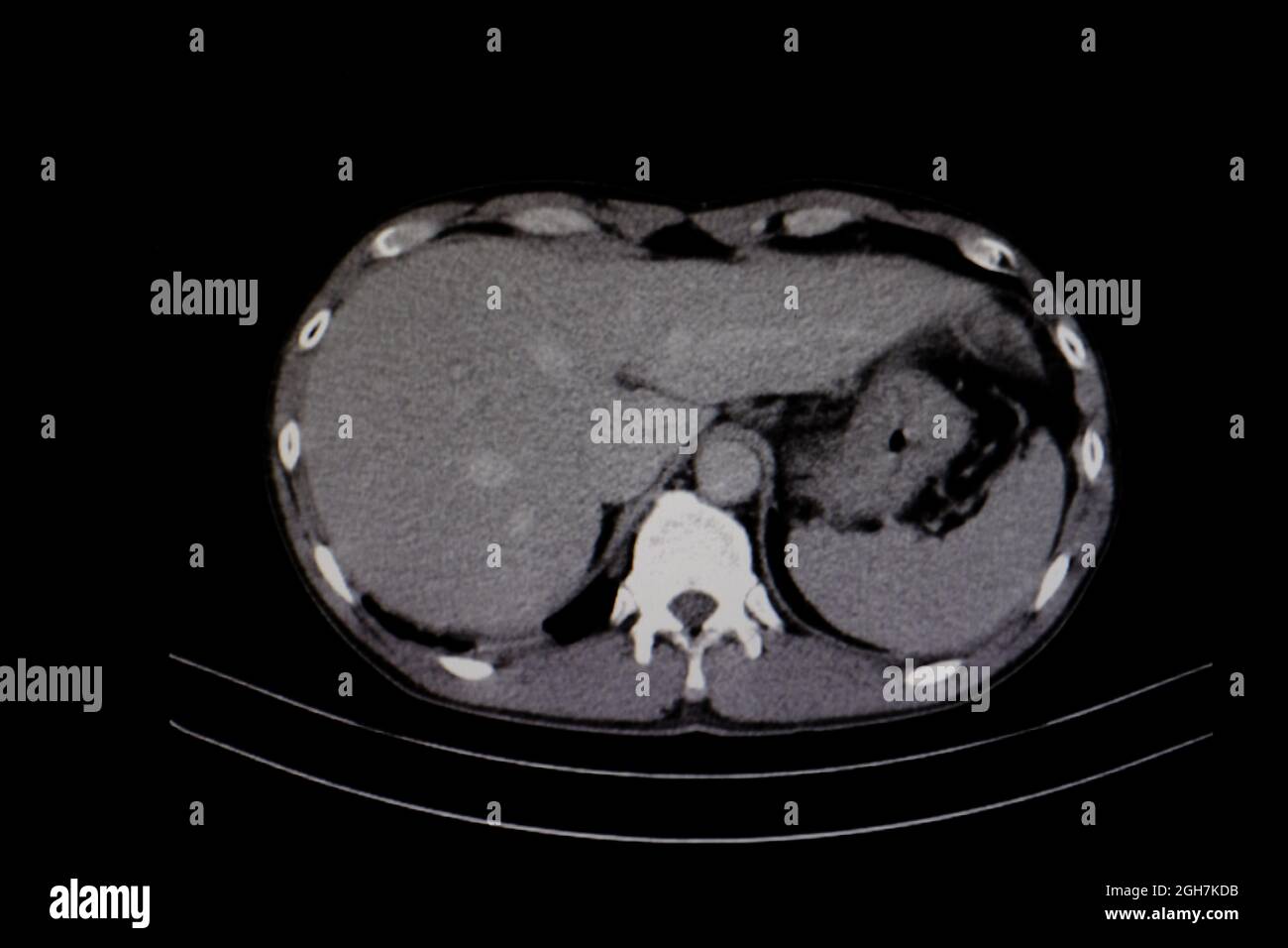 Scanner de diagnostic du foie humain Photo Stock - Alamy