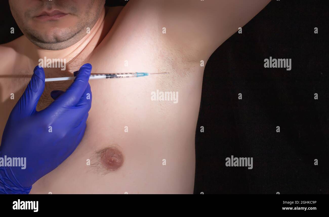 traitement de l'hyperhidrose chez un homme avec des aisselles. Concept de transpiration Banque D'Images