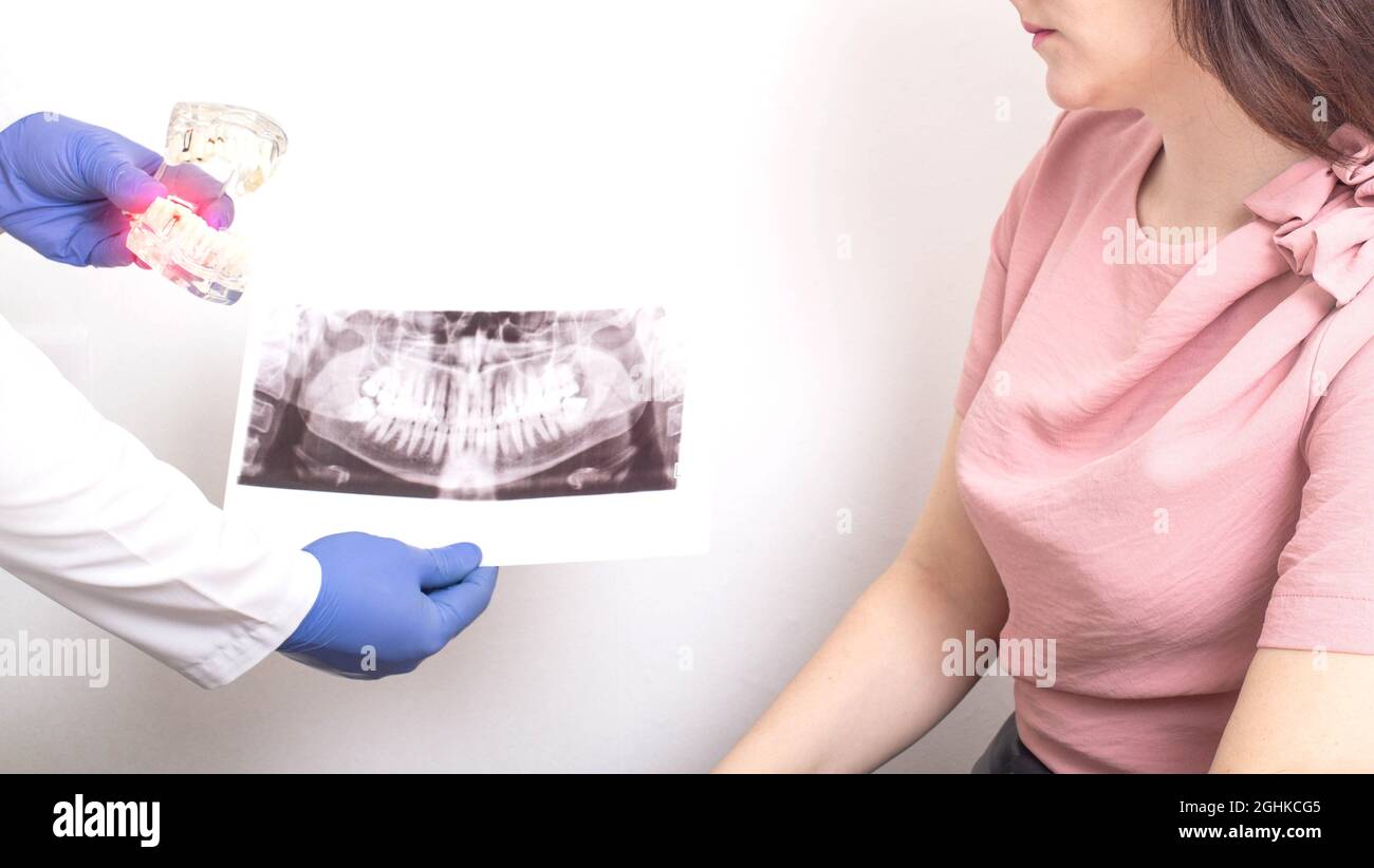 Le médecin dentiste possède une image panoramique des rayons X et une maquette du concept de mâchoire dentaire humaine de mal de dents aigu, gingivite Banque D'Images