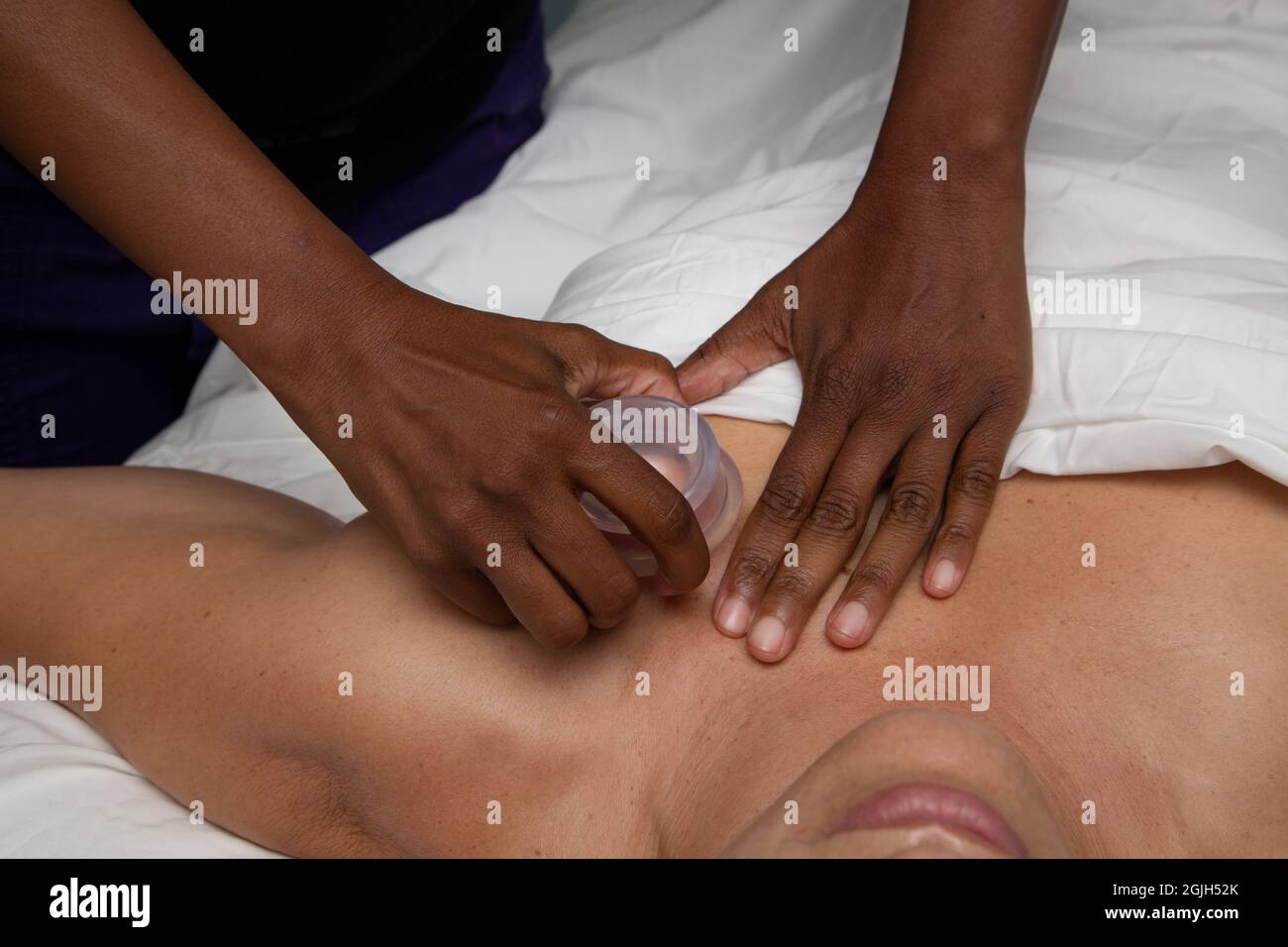 La massothérapeute femme noire applique des ventouses sur un client femme blanc Banque D'Images