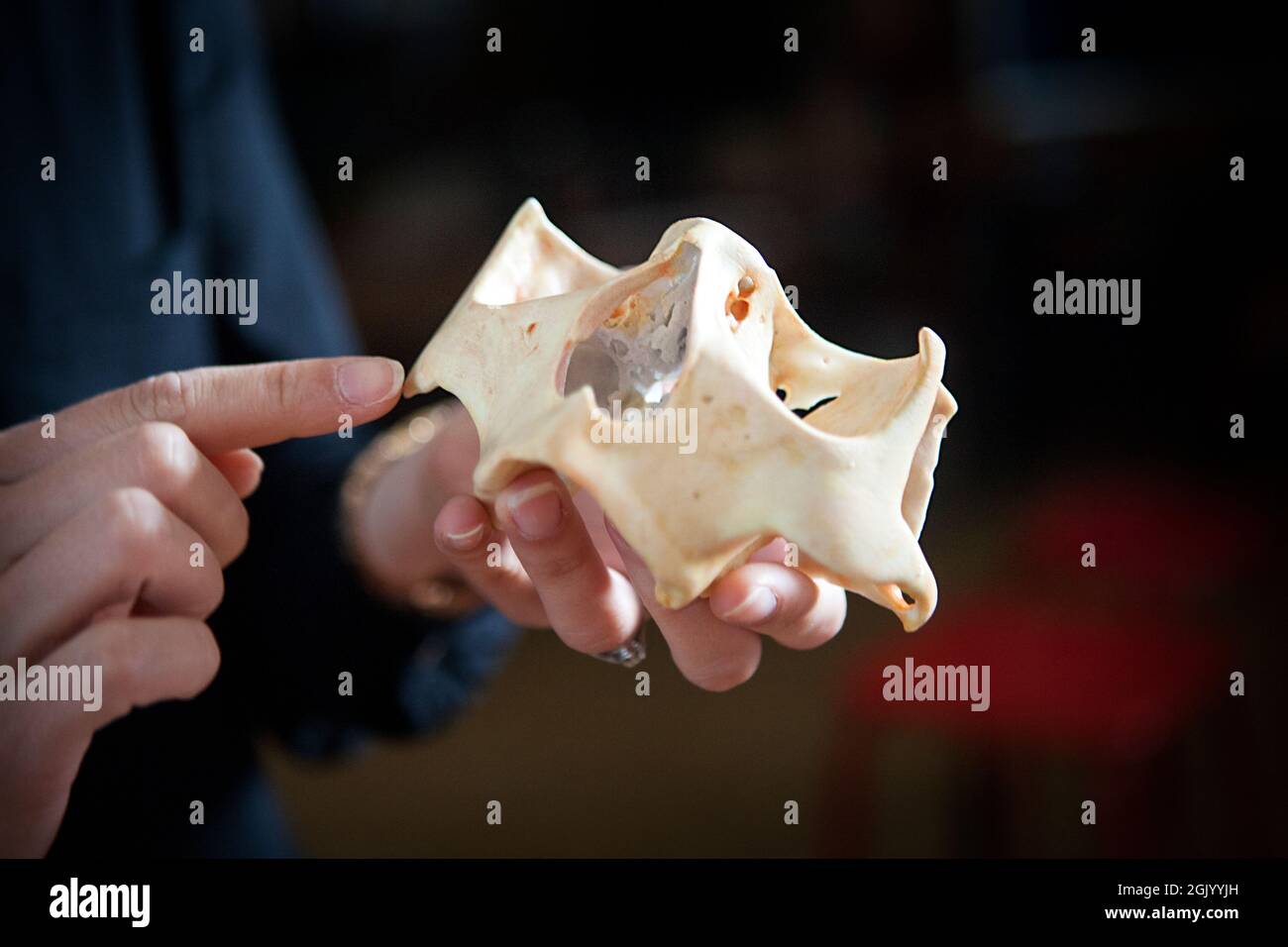 Reconstructions 3D à partir d'images patient, exemples d'impressions 3D. Banque D'Images