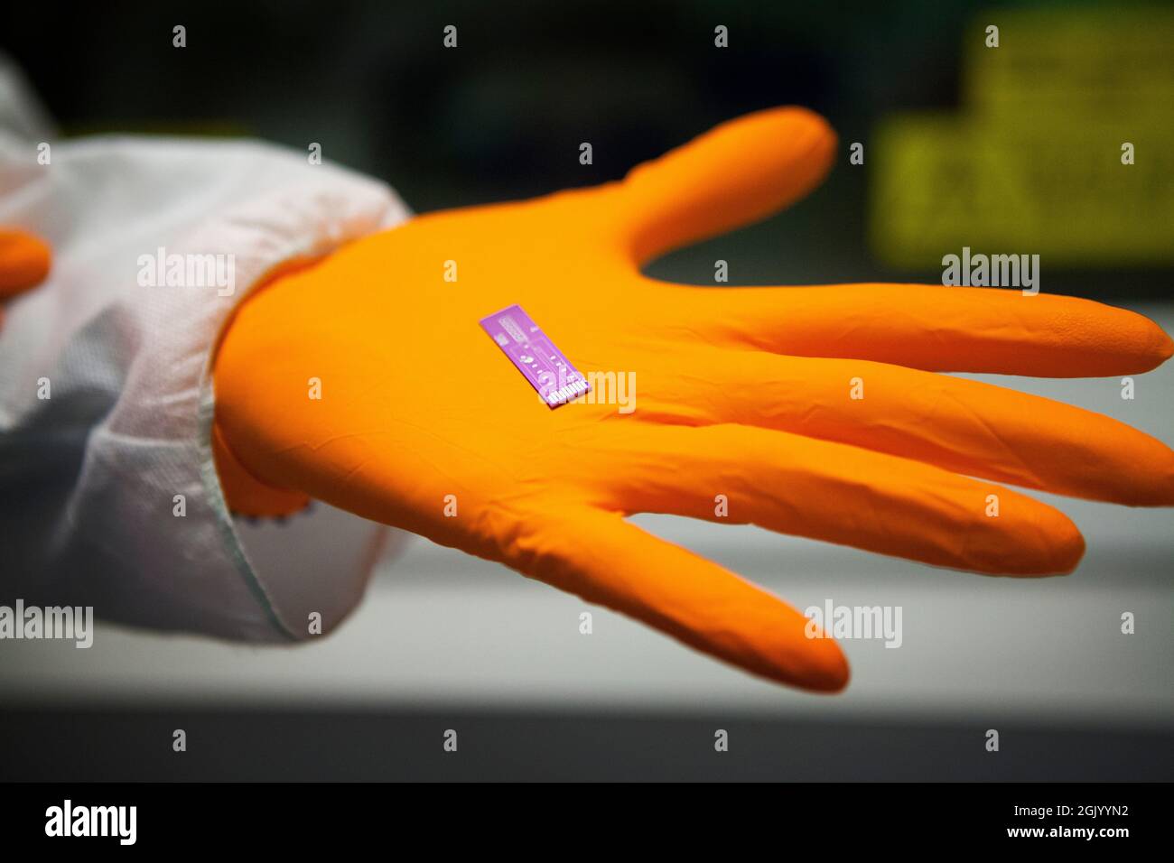 Surveillance du métabolisme humain avec un implant équipé de 5 bio-capteurs capables de détecter des molécules telles que le glucose ou le cholestérol. Banque D'Images