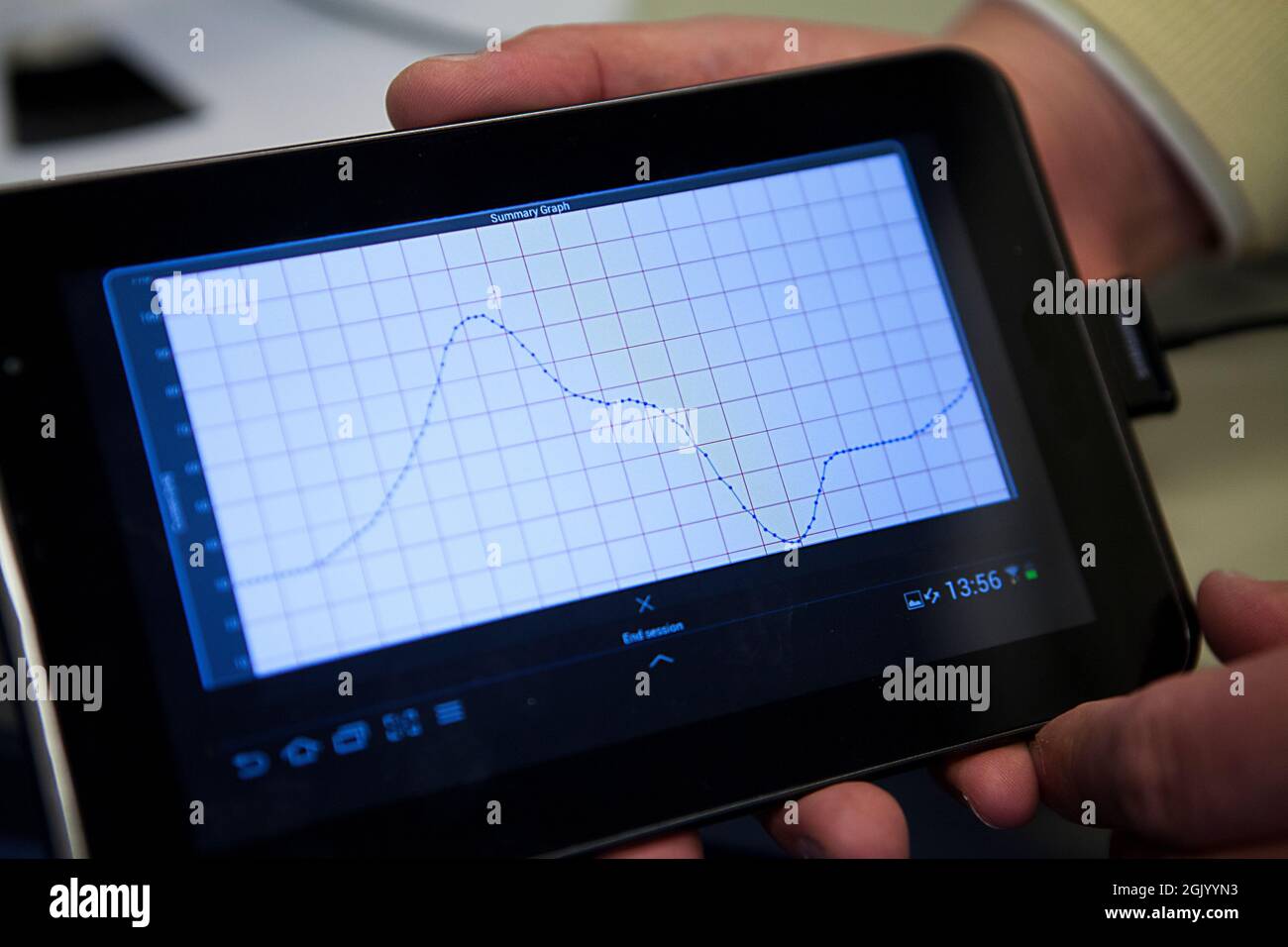 Surveillance du métabolisme humain avec un implant équipé de 5 bio-capteurs capables de détecter des molécules telles que le glucose ou le cholestérol. Banque D'Images