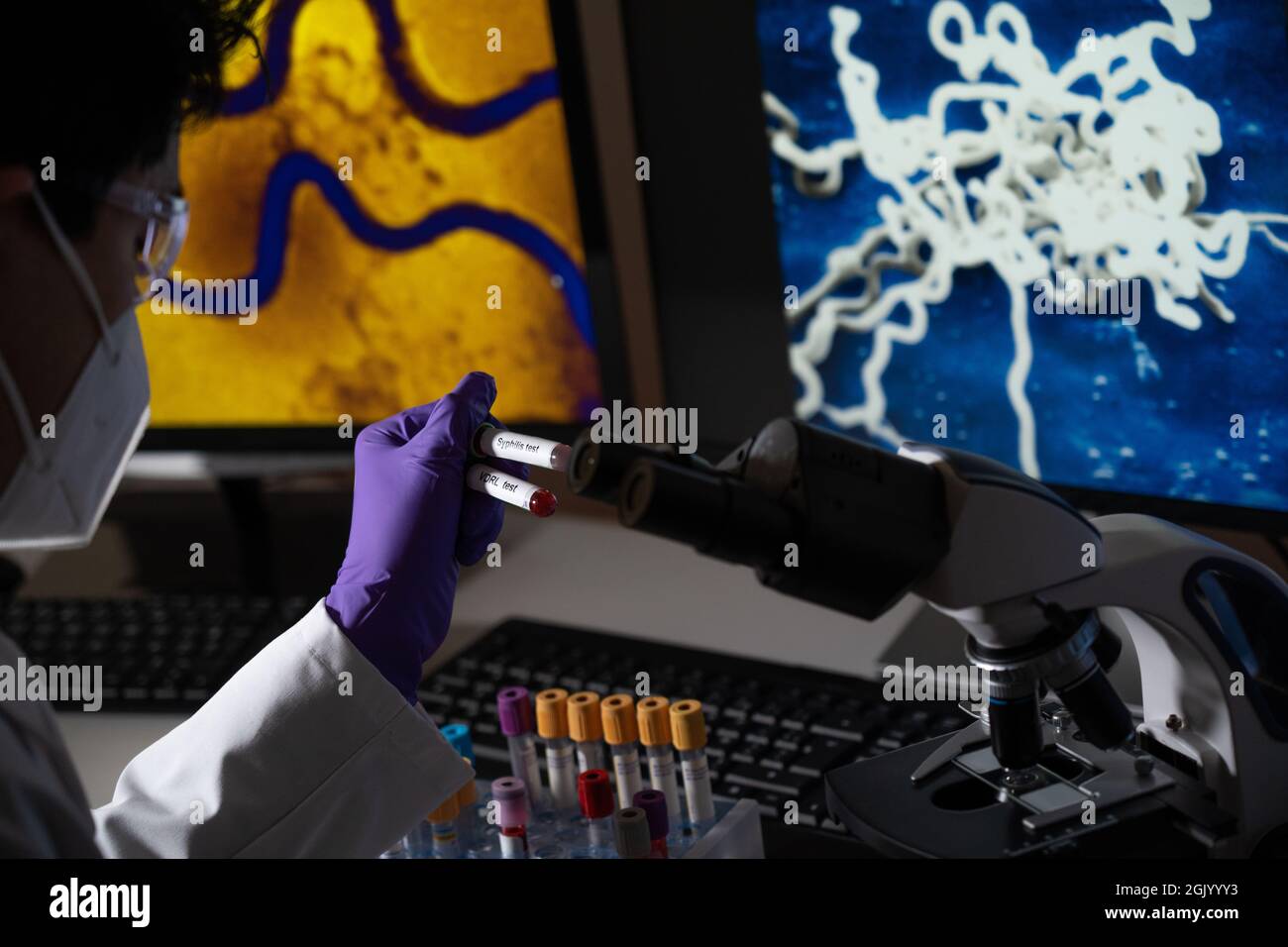 Test sanguin pour la syphilis causée par la bactérie treponema pallidum ou treponema pâle. Cette infection est transmise sexuellement. Banque D'Images