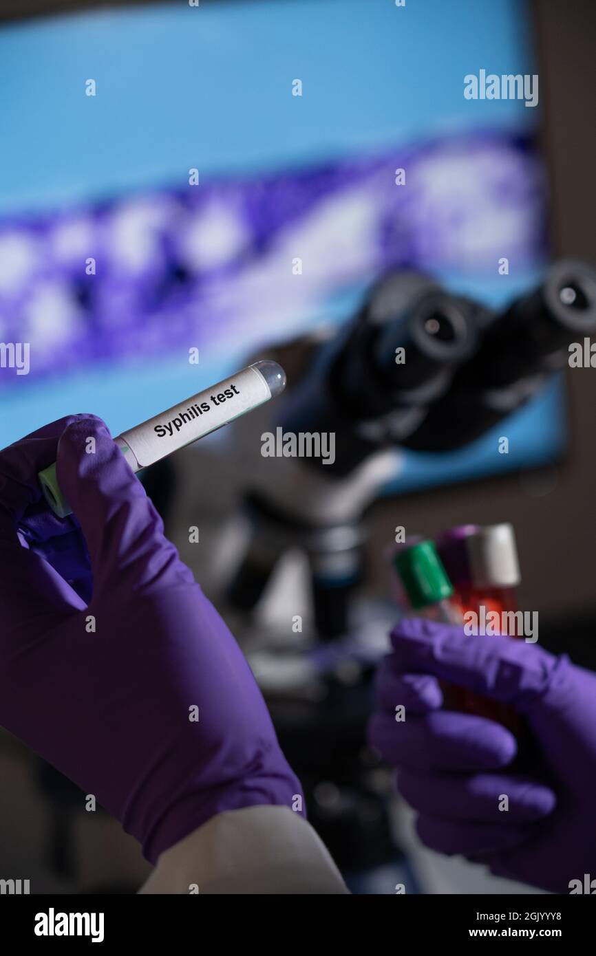 Test sanguin pour la syphilis causée par la bactérie treponema pallidum ou treponema pâle. Cette infection est transmise sexuellement. Banque D'Images