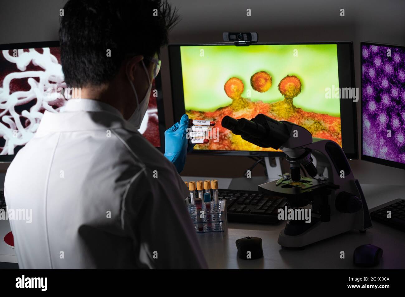 Tests sanguins pour détecter les maladies sexuellement transmissibles ou MST : hépatite B et C, syphilis, VIH. Banque D'Images